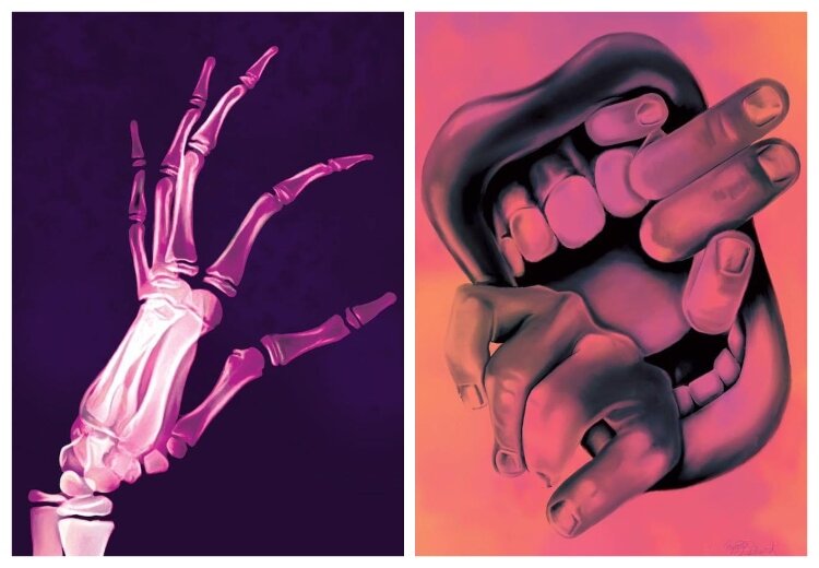 Two powerful works by Rynita McGuire: Beauty is Bone Deep is an x-ray-style drawing of her hand, showing the effects of arthrogryposis. My Hands, My Life illustrates how she uses her mouth to draw, paint, and DJ—tasks most do with their hands.